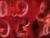 Understanding Fetal Growth Restriction: Causes And Management