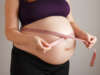 Understanding Fetal Macrosomia: Causes And Management