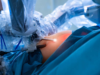 Addressing Fertility Challenges In Transgender Individuals