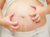 Itchy Skin During Pregnancy: Causes, Conditions, and Care